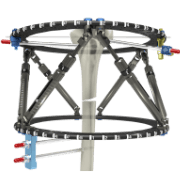 External Fixators