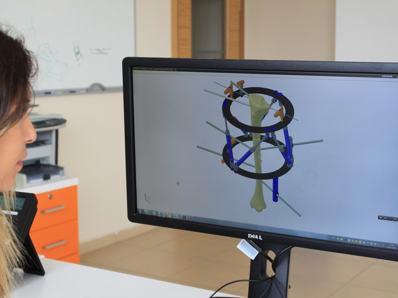 Siemens NX CAD model of a Smart Fixator hexapod frame on a monitor