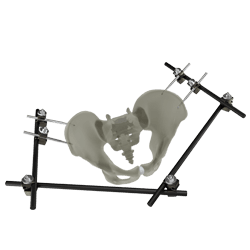 UniX® Large Bar Fixator