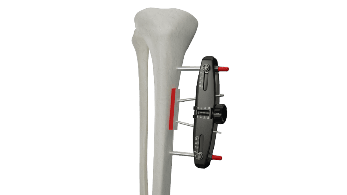 MicroLift