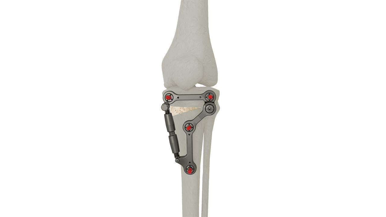 UniPlasty®