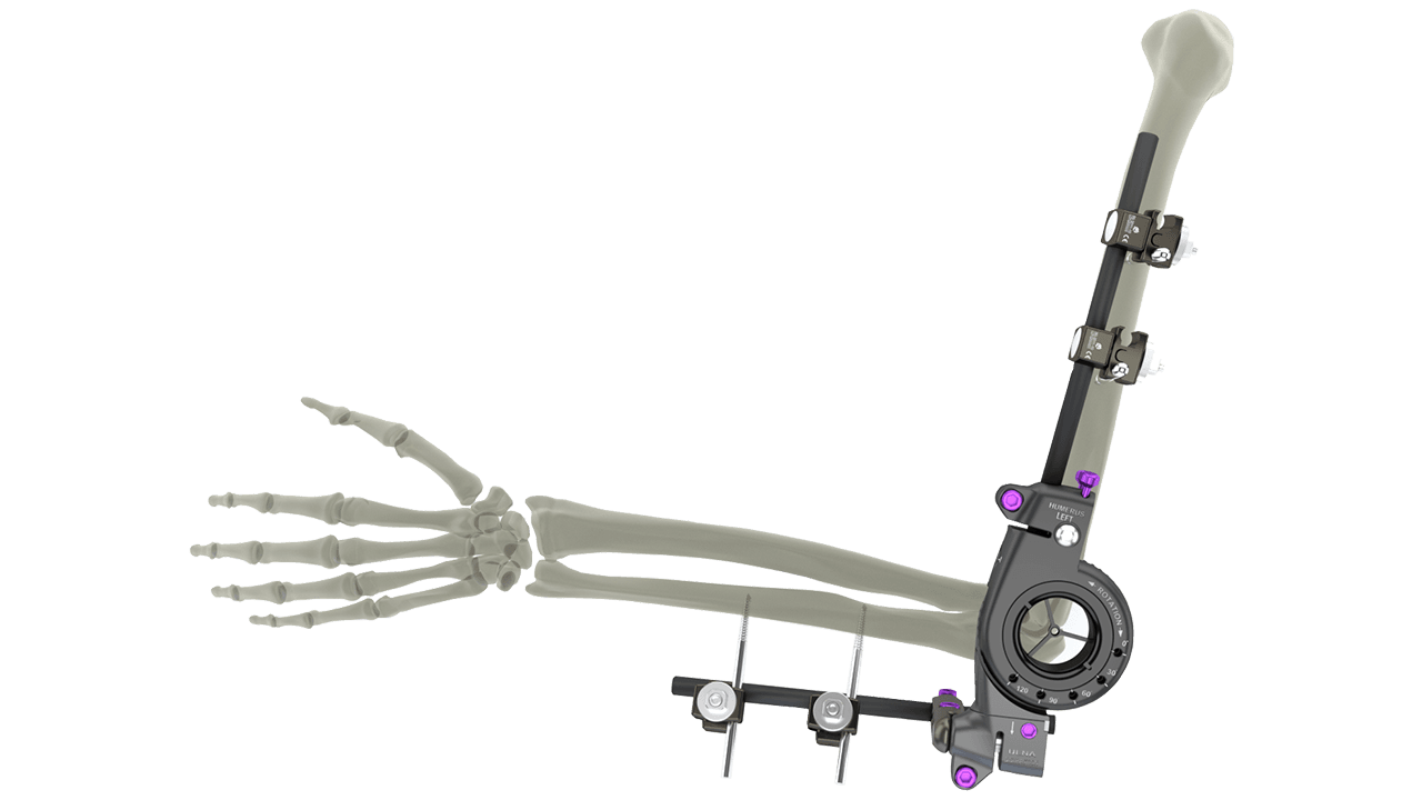 UniX® Elbow