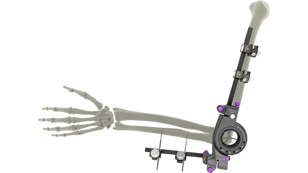 UniX® PDF Elbow Fixator — view 1