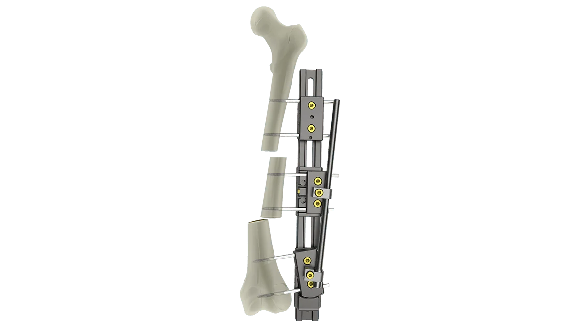UniX® Rail Fixator — view 1