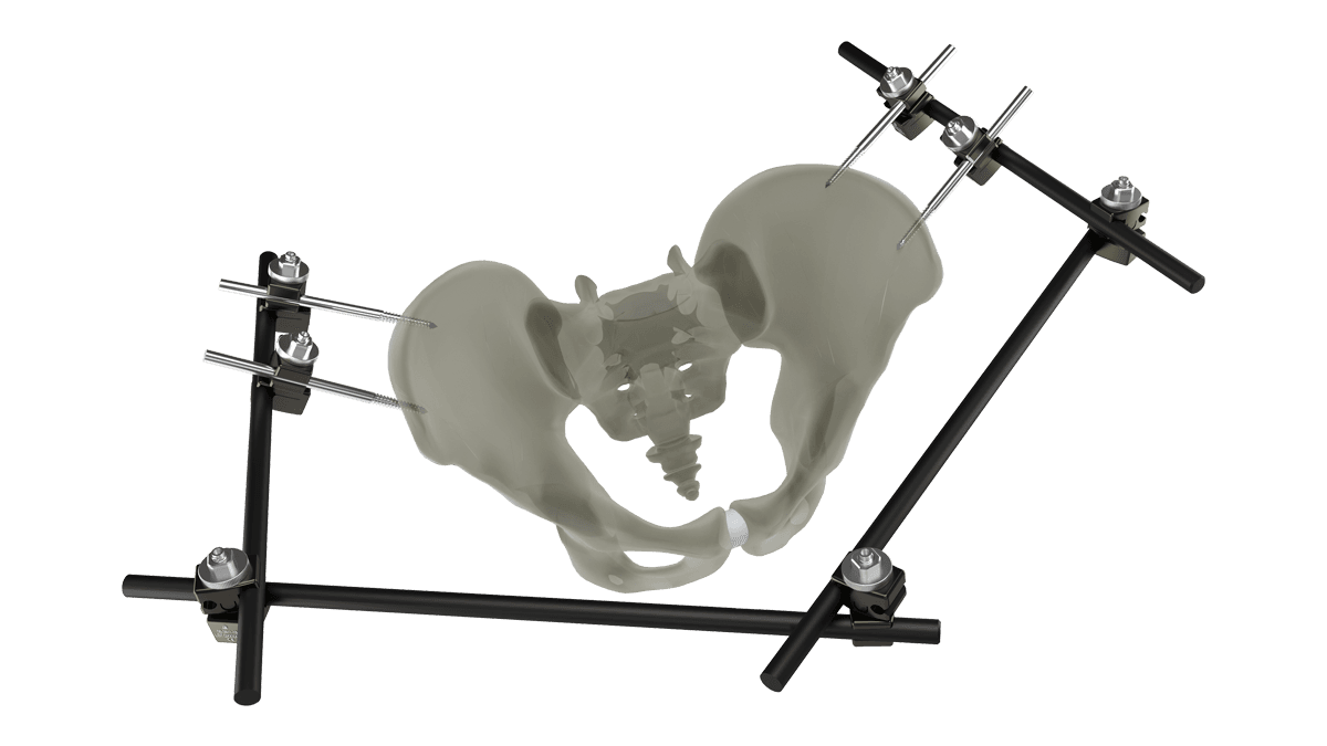 UniX® Large Bar Fixator — view 1