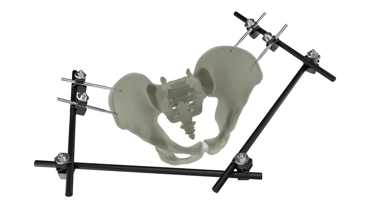 UniX® Large Bar Fixator — view 1