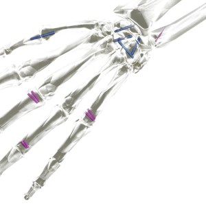 Headless Compression Screw System