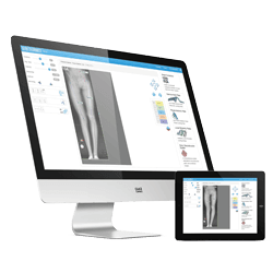 Smart Fixator - PreOperative Planning Software